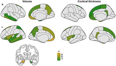 Divergent patterns of cognitive deficits and structural brain alterations between older adults in mixed-sex and same-sex relationships